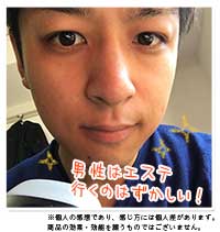 脱毛器ケノンユーザー様の声
