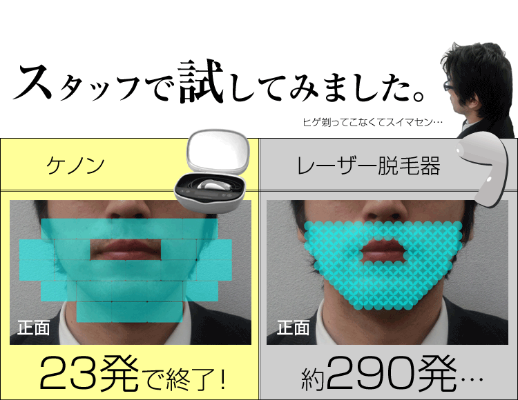 ヒゲレーザーVSケノン03