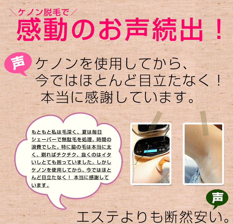 脱毛器ケノンでアンダーヘア脱毛