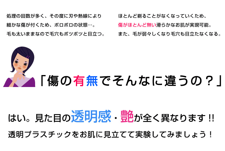 除毛は危険!?-08
