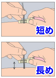 Vライン脱毛の救世主snsで話題騒然の脱毛器ってなに